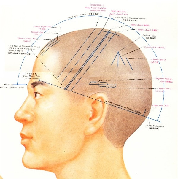 scalp acupuncture head model