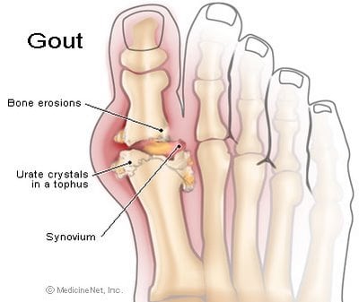 image of skeletal foot